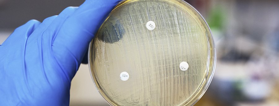 Microbiological Monitoring of Areas 